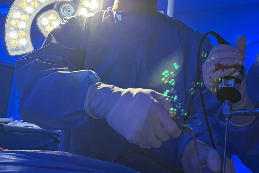 Tratamiento de hematoma subdural en CDMX